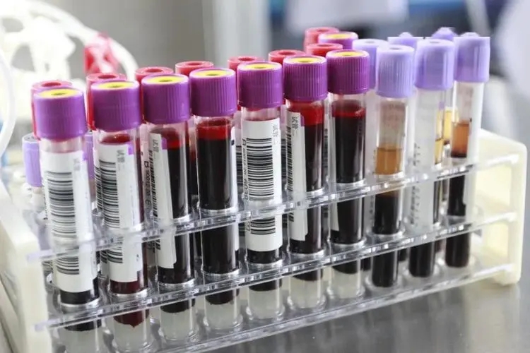香港验血Y-DNA鉴定孕妈抽血常见的问题