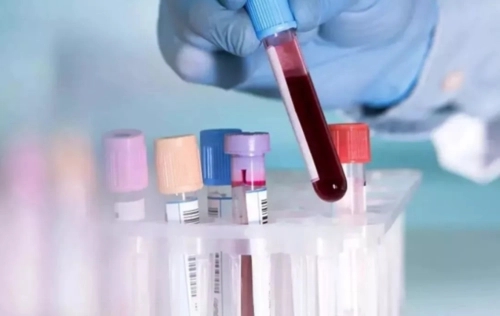 香港验血做性别检测你所不知道的那些事？