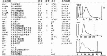 香港验血单显示Y说明男孩吗(验血有y染色体就是男孩吗) 