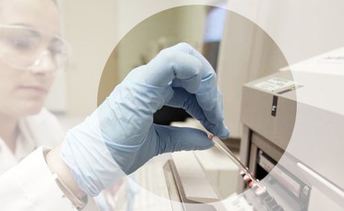 香港验血机构hklab(我想查香港化验所HKLAB的报告,官方网站上 )
