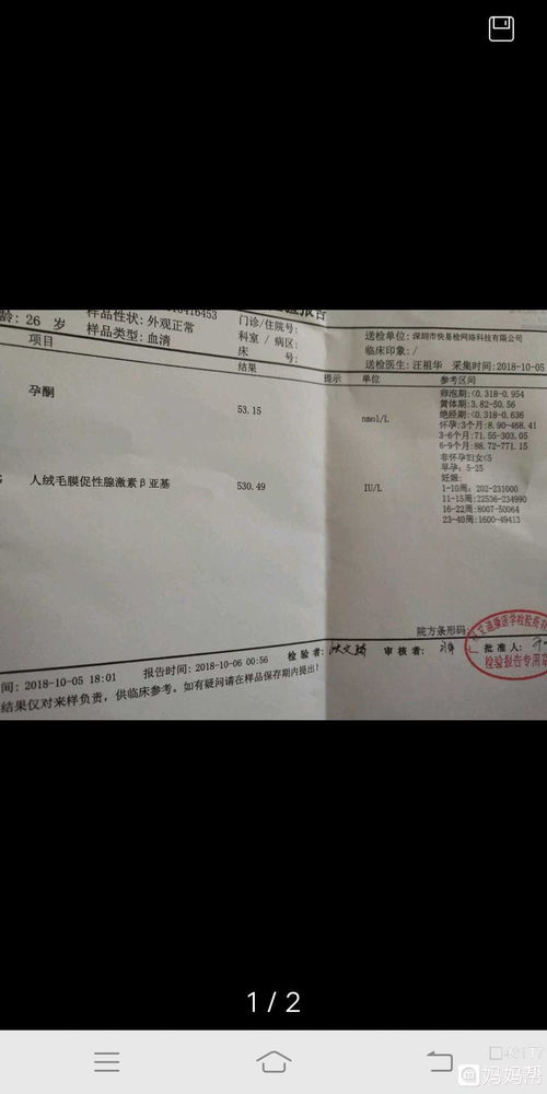 香港验血孕酮低会影响吗(怀男宝是什么感觉 ) 