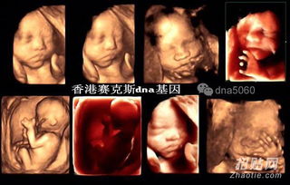 香港验血男孩b超女孩裙(香港验男女原理是什么,准确吗) 