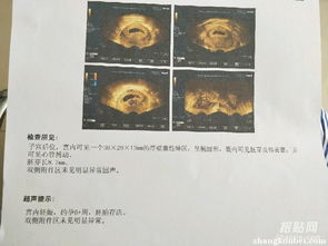 香港验血回来了(怎么看待为生儿子不断打胎现象 ) 