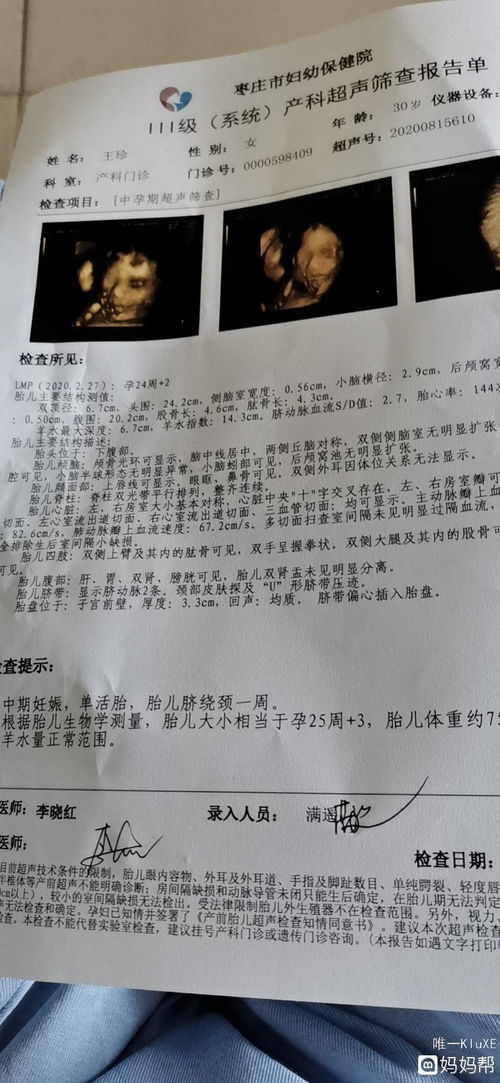 香港男宝女宝验血区别在哪(香港验血检查安全吗 有风险吗 ) 