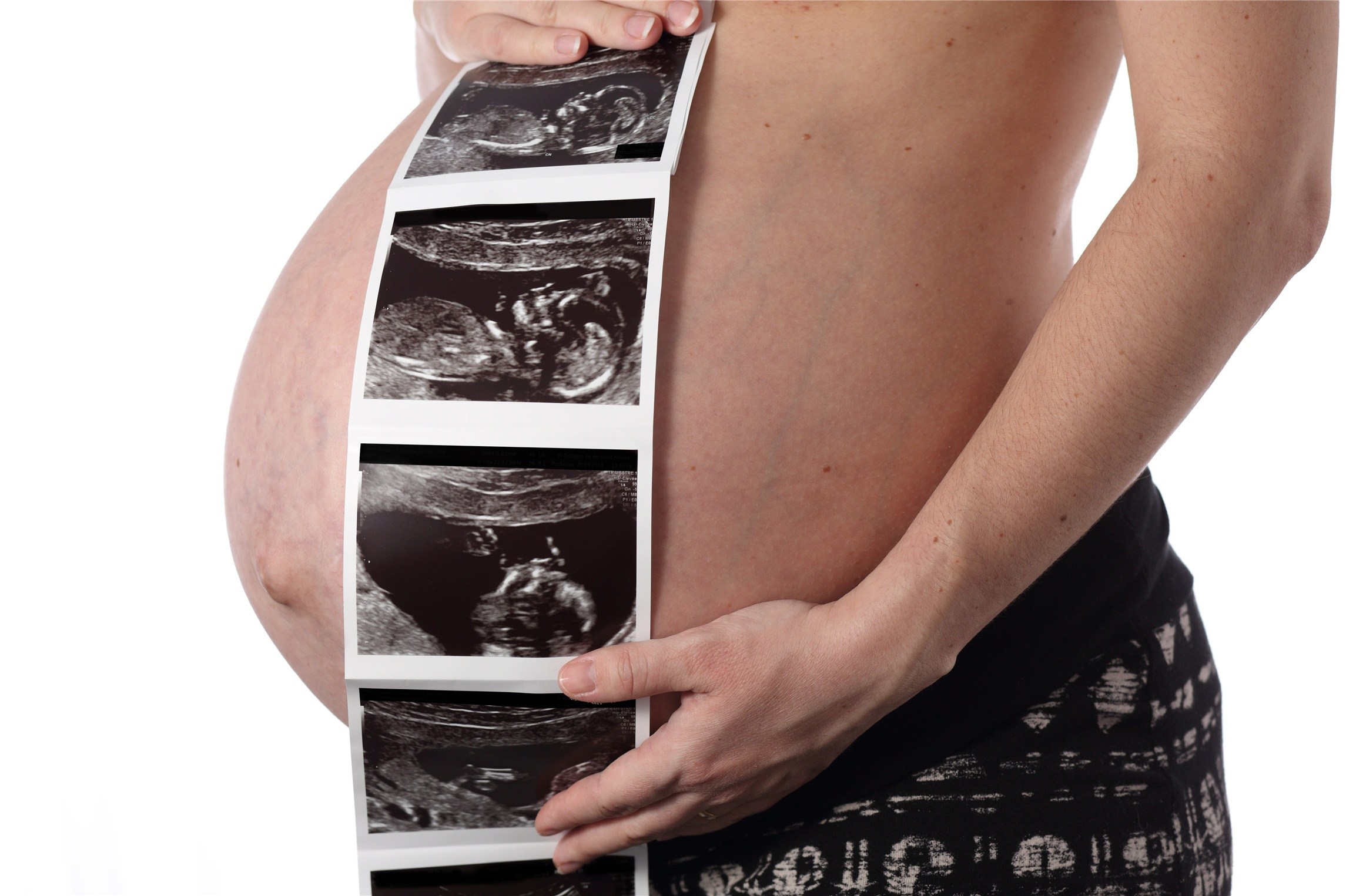 香港验血判定男女性别准确率百分之百吗?，怀孕几周查？