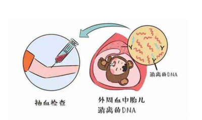 怀孕最佳几周可去香港做无创DNA产前检测呢？
